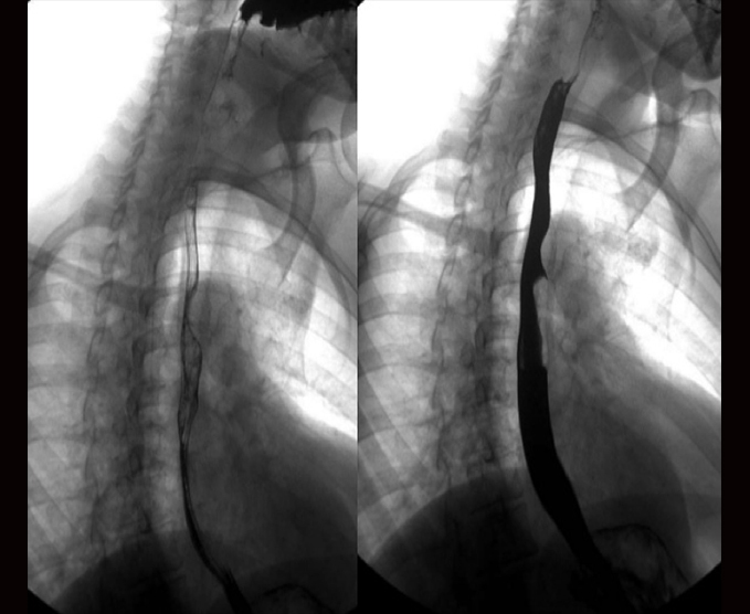 Serie esógafo gastroduodenal